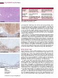 Vorschauseite 3: Die Nieren-Immunhistochemie hilft bei der Differenzialdiagnose.