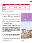 Vorschauseite 4: Die Nieren-Immunhistochemie hilft bei der Differenzialdiagnose.
