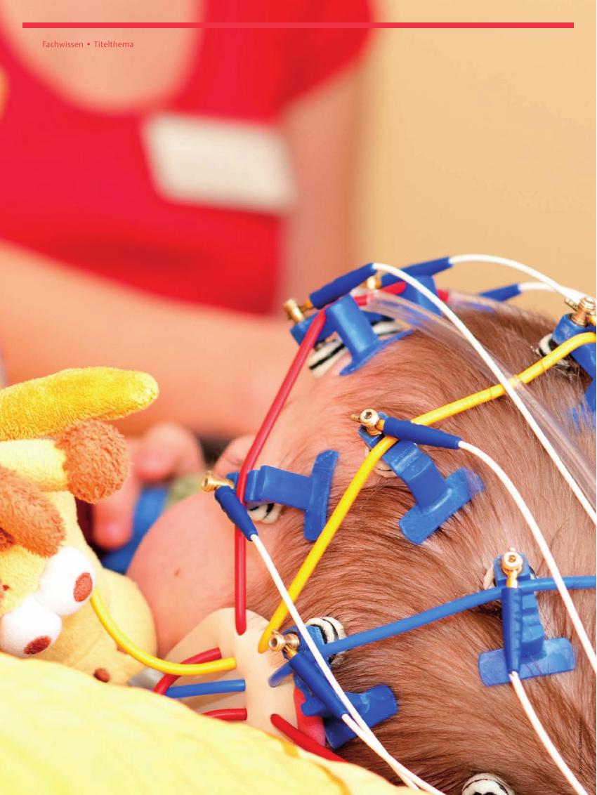 Vorschauseite 1: Fieberkrampf ? Ein häufiger Kindernotfall