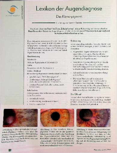 Vorschauseite 1: Lexikon der Augendiagnose: Das Körnerpigment