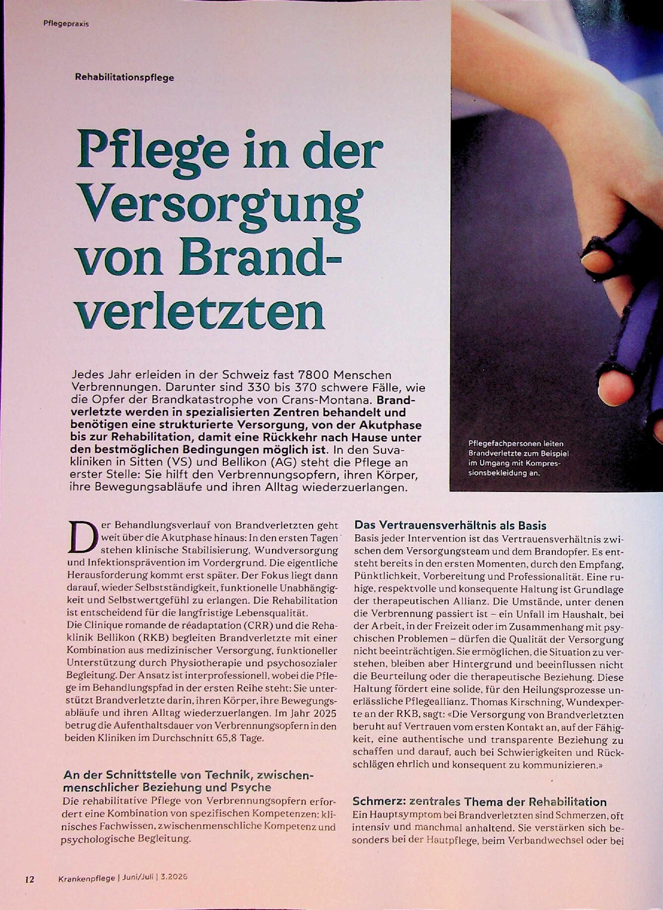 Vorschauseite 1: Pflege in der Versorgung von Brandverletzten