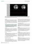 Vorschauseite 4: Neuro-urologische Krankheitsbilder in der neurologischen (Früh-)Rehabilitation
