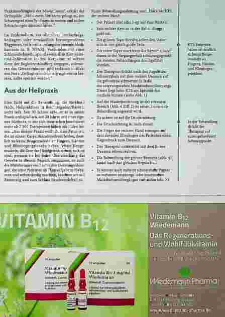 Vorschauseite 3: Das Karpaltunnelsyndrom - ein Nerv steht unter Druck