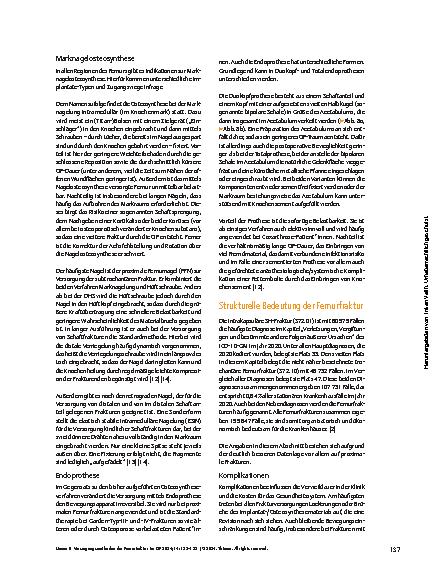 Vorschauseite 6: Versorgungsmethoden der Femurfraktur