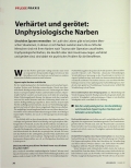 Vorschauseite 1: Verhärtet und gerötet: Unphysiologische Narben