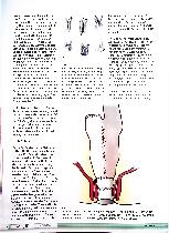 Vorschauseite 2: Kontinentes Ileostoma