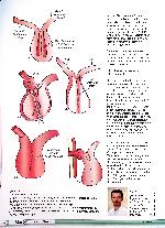 Vorschauseite 4: Kontinentes Ileostoma
