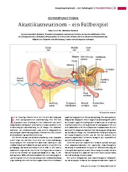 Vorschauseite 1: Akustikusneurinom – ein Fallbeispiel