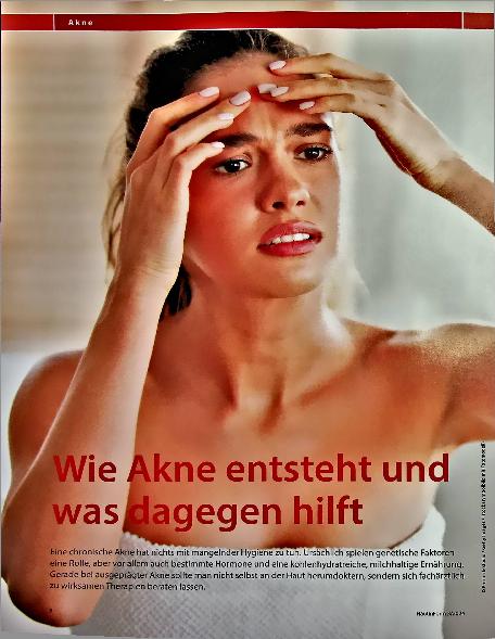 Vorschauseite 1: Wie Akne entsteht und was dagegen hilft