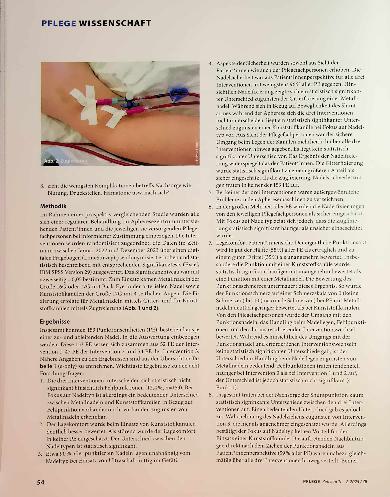 Vorschauseite 3: Shuntpunktion zur Durchführung einer Immunapherese