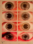 Vorschauseite 2: Miasmen im Auge Teil 3: Sykose