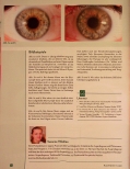 Vorschauseite 4: Miasmen im Auge Teil 3: Sykose