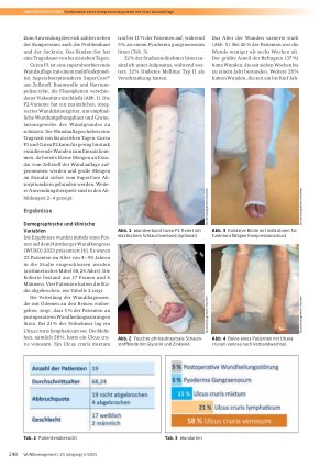 Vorschauseite 3: Kombination des Kompressionssystems CoFlex TLC zinc/calamine mit der superabsorbierenden Wundauflage curea P1/P2
