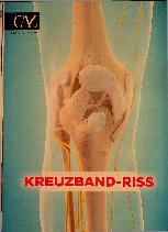 Vorschauseite 1: Kreuzbandriss