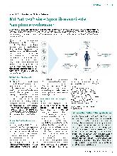 Vorschauseite 1: Spastik-Plus-Komplex« bei Multipler Sklerose Mit Sativex® viele Spastik-assoziierte Symptome verbessern