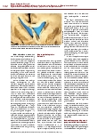 Vorschauseite 5: Hypoxisch-ischämische Hirnschädigung: Verlaufsbeobachtungen, Prognose und Therapieentscheidungen