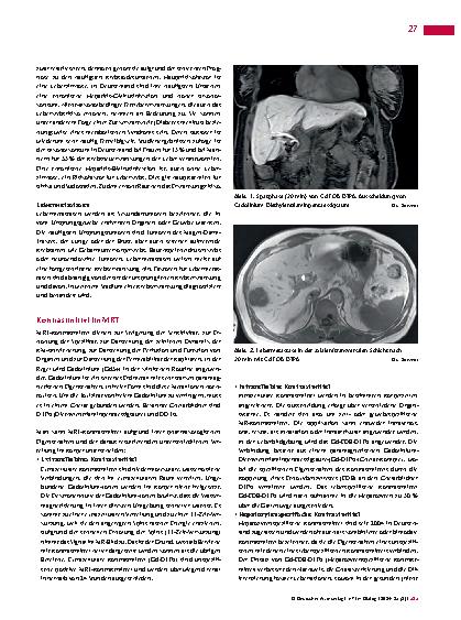 Vorschauseite 2: Leberdiagnostik in der Magnetresonanztomografie