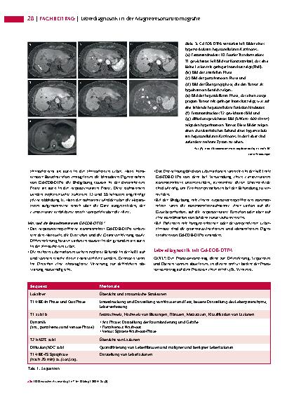 Vorschauseite 3: Leberdiagnostik in der Magnetresonanztomografie