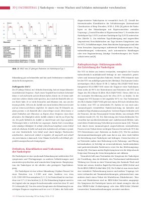 Vorschauseite 3: Narkolepsie – wenn Wachen und Schlafen miteinander verschmelzen