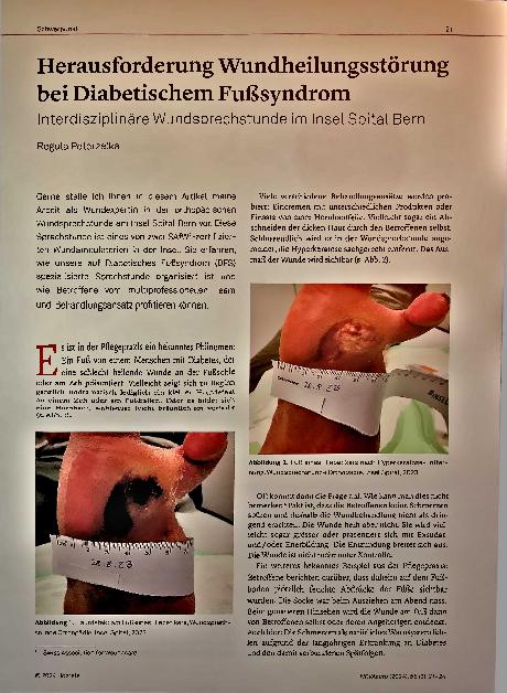 Vorschauseite 1: Herausforderung Wundheilungsstörung bei Diabetischem Fußsyndrom Interdisziplinäre Wundsprechstunde im Inselspital Bern