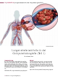 Vorschauseite 1: Lungenarterienembolie in der Computertomografie (Teil 1)