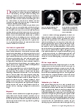 Vorschauseite 2: Lungenarterienembolie in der Computertomografie (Teil 1)