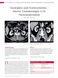 Vorschauseite 1: Anomalien und Normvarianten - Interne Veränderungen 2. 14: Nierenmalrotation
