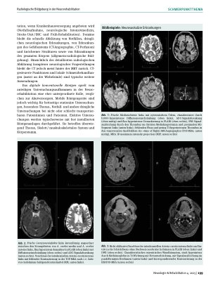 Vorschauseite 2: Radiologische Bildgebung in der Neurorehabilitation