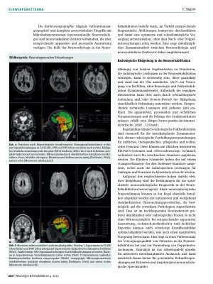 Vorschauseite 3: Radiologische Bildgebung in der Neurorehabilitation