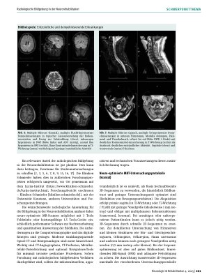 Vorschauseite 4: Radiologische Bildgebung in der Neurorehabilitation