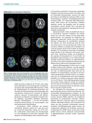 Vorschauseite 5: Radiologische Bildgebung in der Neurorehabilitation