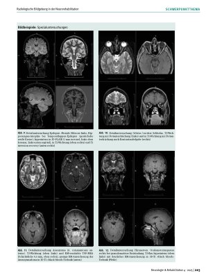 Vorschauseite 6: Radiologische Bildgebung in der Neurorehabilitation