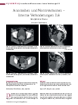 Vorschauseite 1: Anomalien und Normvarianten – Interne Veränderungen 2.8 Retroflektierter Uterus