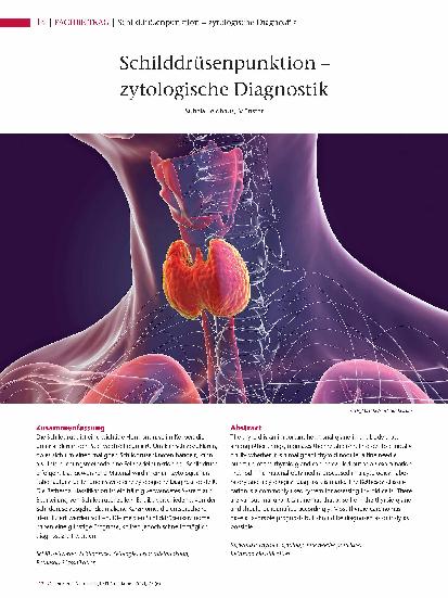 Vorschauseite 1: Schilddrüsenpunktion – zytologische Diagnostik
