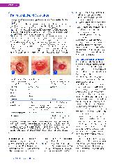 Vorschauseite 5: Malnutrition - Störfaktor für die Wundheilung
