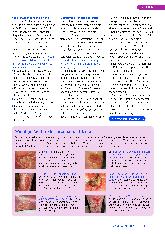 Vorschauseite 6: Malnutrition - Störfaktor für die Wundheilung