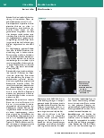 Vorschauseite 5: Therapiebegleitende Diagnostik bei COVID-19-Patienten mittels fokussierter Multiorgan-Sonographie