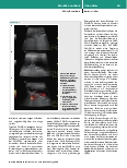Vorschauseite 6: Therapiebegleitende Diagnostik bei COVID-19-Patienten mittels fokussierter Multiorgan-Sonographie