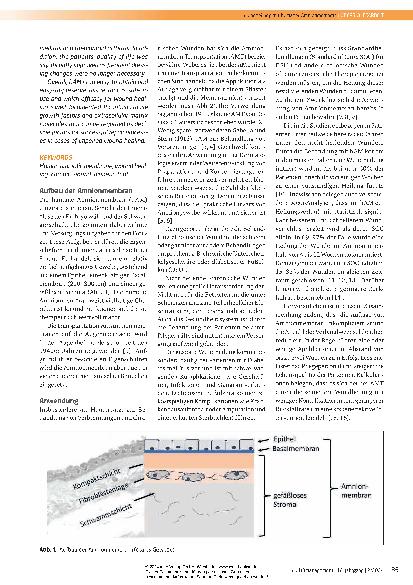 Vorschauseite 2: Wundheilung mit humaner Amnionmemran – eine Therapieoption bei Wundheilungsstörungen