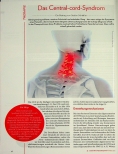Vorschauseite 1: Das Zentral-cord-Syndrom