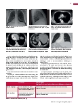Vorschauseite 2: Anomalien und Normvarianten: Interne Veränderungen 2.9 Dextrokardie
