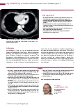Vorschauseite 3: Anomalien und Normvarianten: Interne Veränderungen 2.9 Dextrokardie