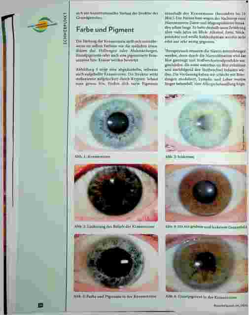 Vorschauseite 3: Die Krausenzone im Auge ist eine Reflexzone für Magen und Darm.