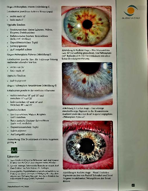 Vorschauseite 2: Lexikon der Augendiagnose Topografie: Organ-Nebenplätze nach Josef Angerer