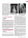 Vorschauseite 2: Anomalien und Normvarianten: Skelettale Veränderungen 3. 20 Kielund Trichterbrust
