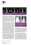 Vorschauseite 3: Das Lungenkarzinom: Diagnostik und Therapiekonzepte – eine Einführung