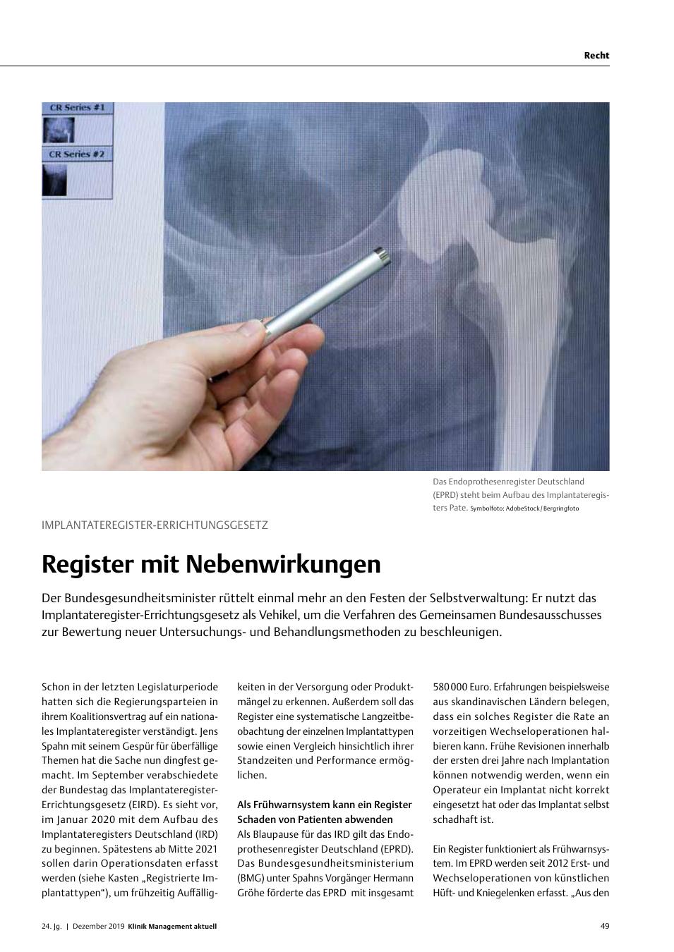 Vorschauseite 1: Implantateregister-Errichtungsgesetz: Register mit Nebenwirkungen