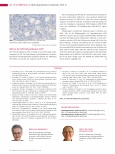 Vorschauseite 3: Myelodysplastische Syndrome (Teil 3) MDS mit Blastenvermehrung