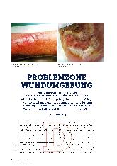 Vorschauseite 1: Problemzone Wundumgebung