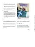 Vorschauseite 4: Patienten in Bauchlage aus Sicht der Anästhesie-Pflege